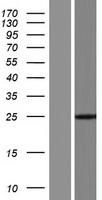 CFC1B Human Over-expression Lysates NM_001079530