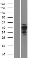 ls653282 ct47a7 human over expression lysates nm 001080140 wb testing 1