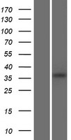 FAM86B2 Human Over-expression Lysates NM_001137610