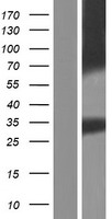 ls653437 aqp12b human over expression lysates nm 001102467 wb testing 1