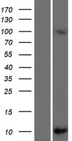 SCGB1C2 Human Over-expression Lysates NM_001097610