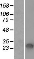 SFTPA1 Human Over-expression Lysates NM_001164644