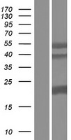 SFTPA1 Human Over-expression Lysates NM_001164646