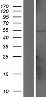 DUX4L7 Human Over-expression Lysates NM_001127387