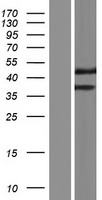 FAM23A (TMEM236) Human Over-expression Lysates NM_001098844