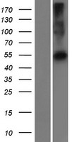 ls653606 pramef22 human over expression lysates nm 001100631 wb testing 1