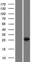 ls653689 glutathione s transferase theta 2 gstt2b human over expression lysates nm 001080843 wb testing 1