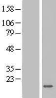 Secretory lectin ZG16 (ZG16) Human Over-expression Lysates NM_152338