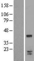 LGALS9C Human Over-expression Lysates NM_001040078