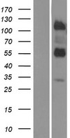 ls654429 lrtm2 human over expression lysates nm 001039029 wb testing 1
