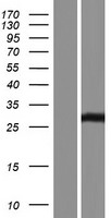 ls727837 ssx2 ssx2b human over expression lysates nm 001164417 wb testing 1