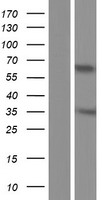 CT47A10 Human Over-expression Lysates NM_001080137