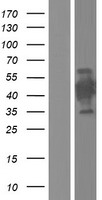 ls728042 ct47a9 human over expression lysates nm 001080138 wb testing 1