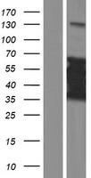 ls728049 ct47a8 human over expression lysates nm 001080139 wb testing 1