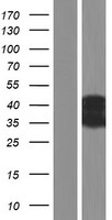 ls728062 ct47a6 human over expression lysates nm 001080141 wb testing 1