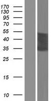 ls728072 ct47a5 human over expression lysates nm 001080142 wb testing 1