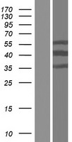 ls728090 ct47a2 human over expression lysates nm 001080145 wb testing 1