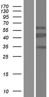CT47A1 Human Over-expression Lysates NM_001080146