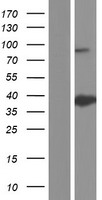 ANXA8L1 Human Over-expression Lysates NM_001098845