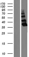 ZBTB8B Human Over-expression Lysates NM_001145720
