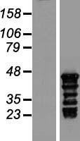TSPY3 Human Over-expression Lysates NM_001077697