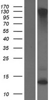 KRTAP2-2 Human Over-expression Lysates NM_033032