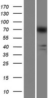 ls728404 agap8 human over expression lysates nm 001077686 wb testing 1