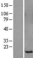 SPANXB1 Human Over-expression Lysates NM_032461