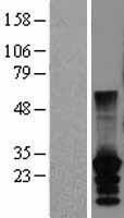 CT45A2 Human Over-expression Lysates NM_152582