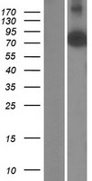AGAP5 Human Over-expression Lysates NM_001144000
