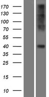 CCR2 Human Over-expression Lysates NM_001123041