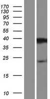 ls729246 prr20d human over expression lysates nm 001130406 wb testing 1