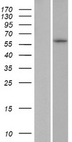 ZNF286B Human Over-expression Lysates NM_001145045
