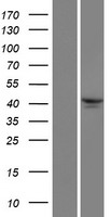 TRIM49D2 Human Over-expression Lysates NM_001105522