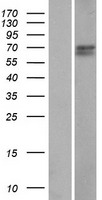 ls729440 ccdc61 human over expression lysates nm 001080402 wb testing 1