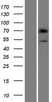 PRAMEF14 Human Over-expression Lysates NM_001099854