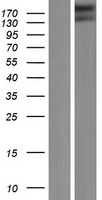 ls729540 rgpd6 human over expression lysates nm 001123363 wb testing 1