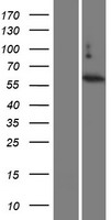 ls729873 tbc1d3 human over expression lysates nm 001123391 wb testing 1