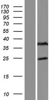 ls730112 fam166b human over expression lysates nm 001099951 wb testing 1
