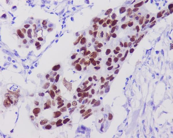 m00001 1 ihc