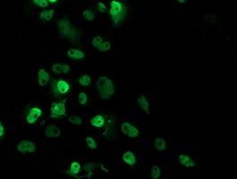 m00001 5 anti p53 tp53 mouse monoclonal antibody clone id oti1d11 if testing 9