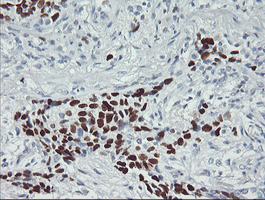 m00001 5 anti p53 tp53 mouse monoclonal antibody clone id oti1d11 ihc testing 3