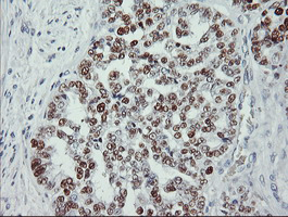 m00001 5 anti p53 tp53 mouse monoclonal antibody clone id oti1d11 ihc testing 4