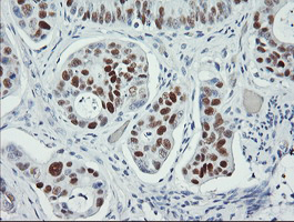 m00001 5 anti p53 tp53 mouse monoclonal antibody clone id oti1d11 ihc testing 5