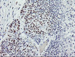 m00001 5 anti p53 tp53 mouse monoclonal antibody clone id oti1d11 ihc testing 6