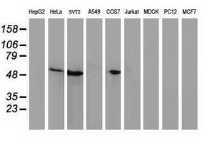 m00001 5 anti p53 tp53 mouse monoclonal antibody clone id oti1d11 wb testing 2