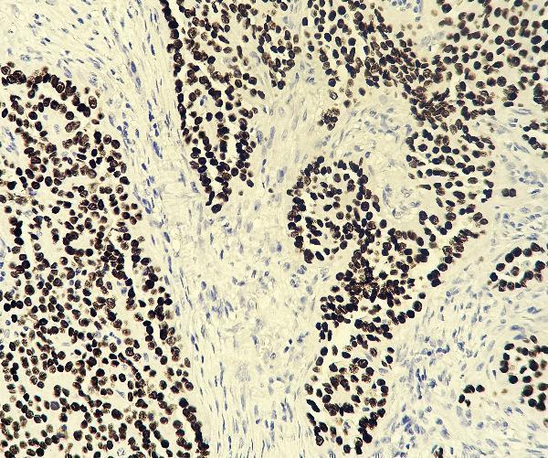 m00001 7 tp53 primary antibodies ihc testing 1