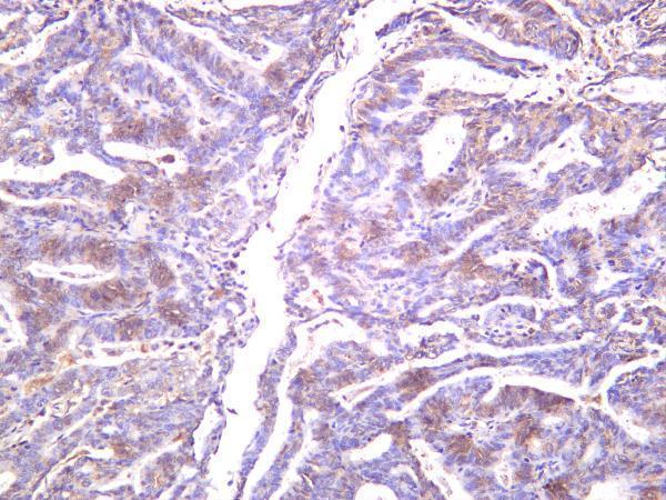 m00003 5 mtor primary antibodies ihc testing 2