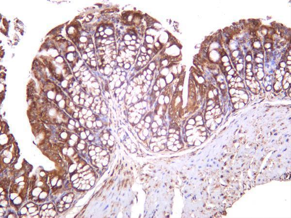 m00003 5 mtor primary antibodies ihc testing 3