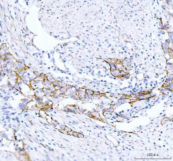 m00004 1 beta_catenin primary antibodies ihc testing 2